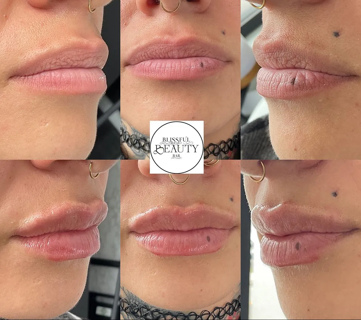 Blissful Beauty Bar | Before and After