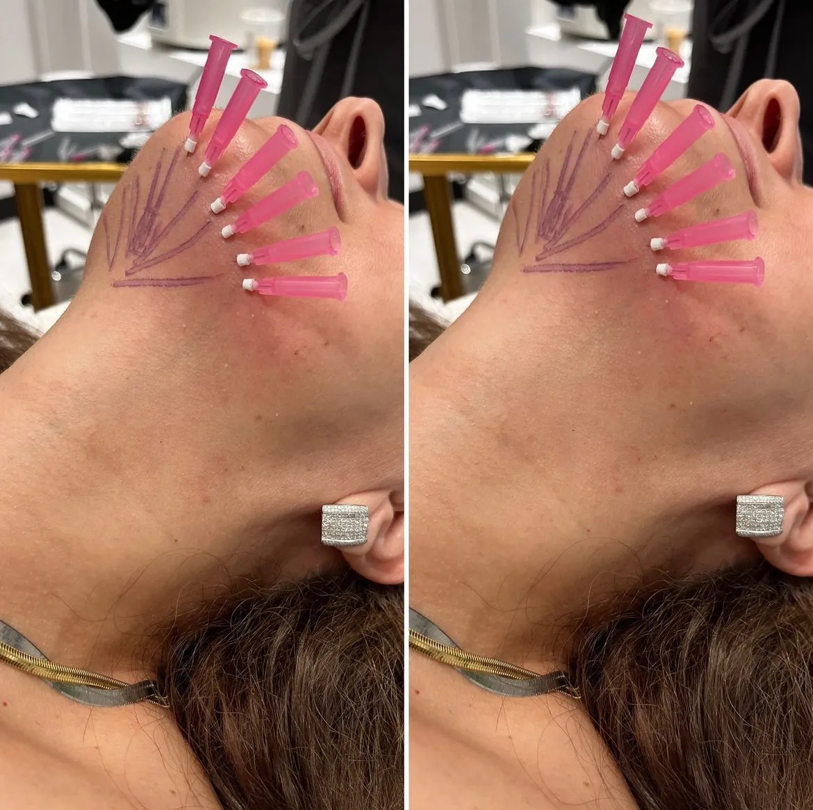 Blissful Beauty Bar | Before and After