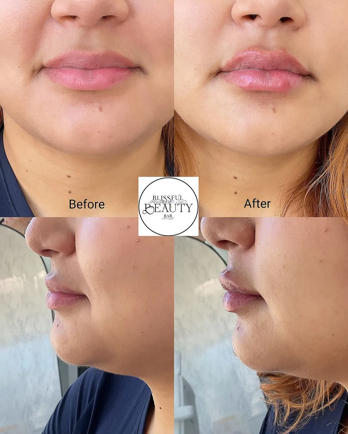 Blissful Beauty Bar | Before and After