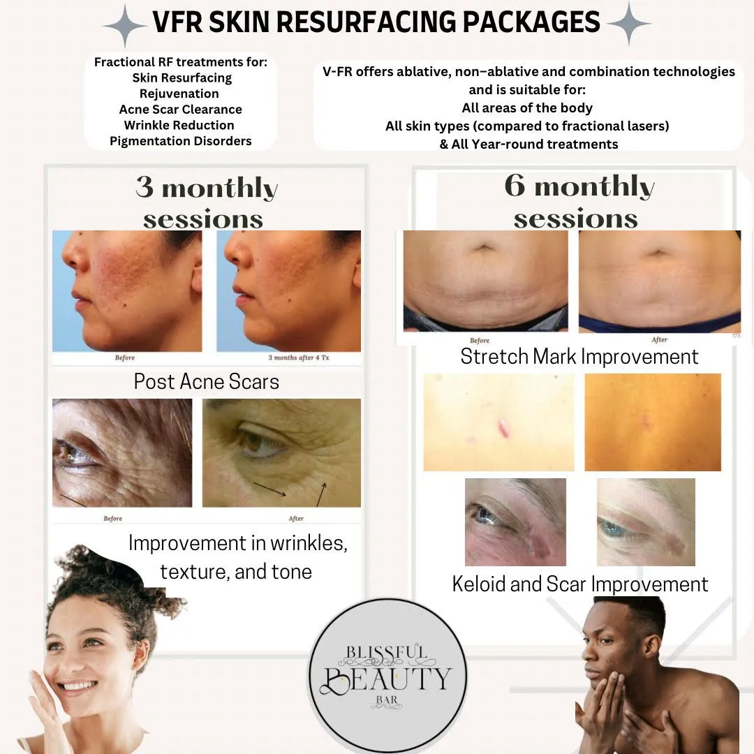 VFR Skin Resurfacing Packages | Blissful Beauty Bar