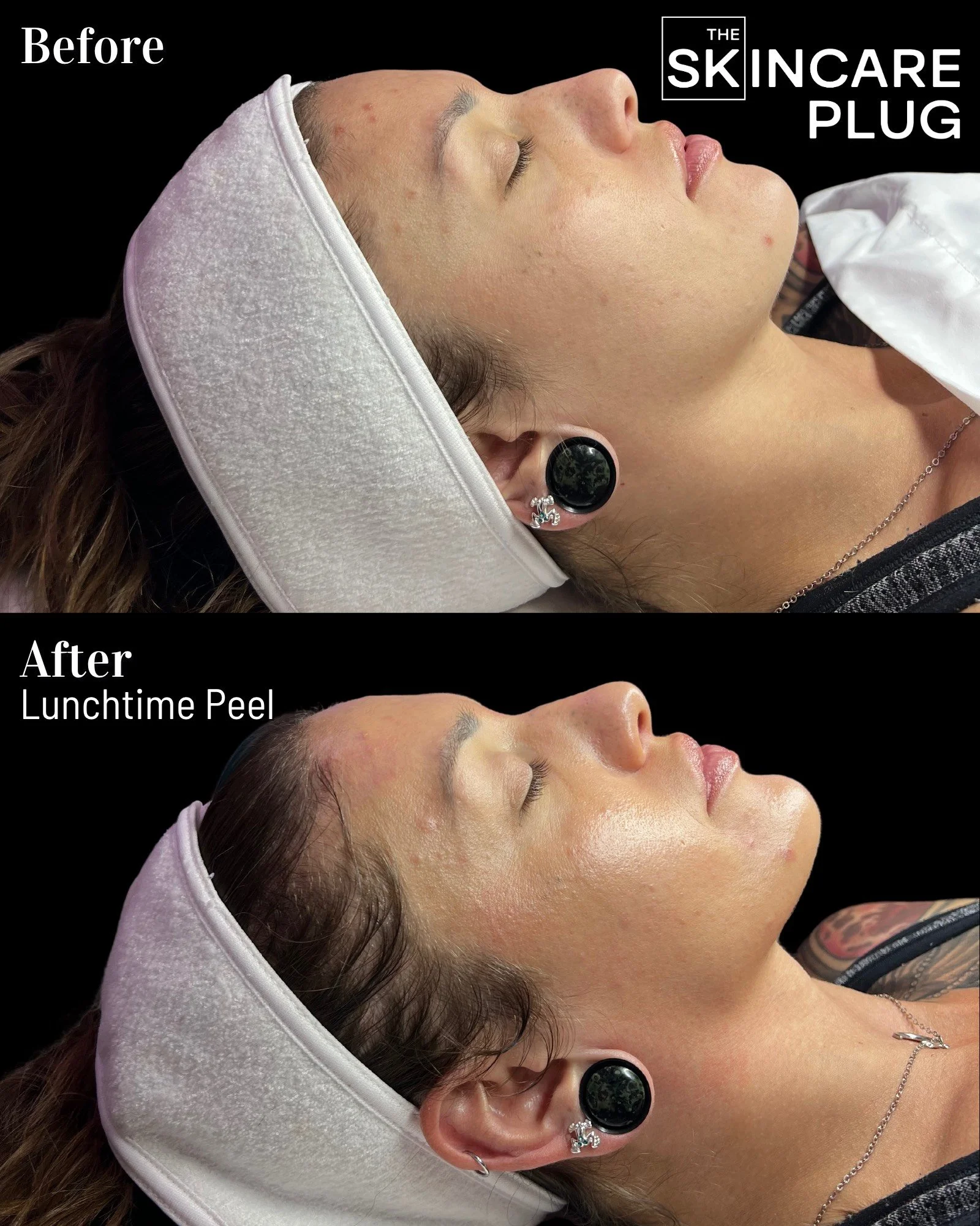 Copy of Before & After.zip - 4.png