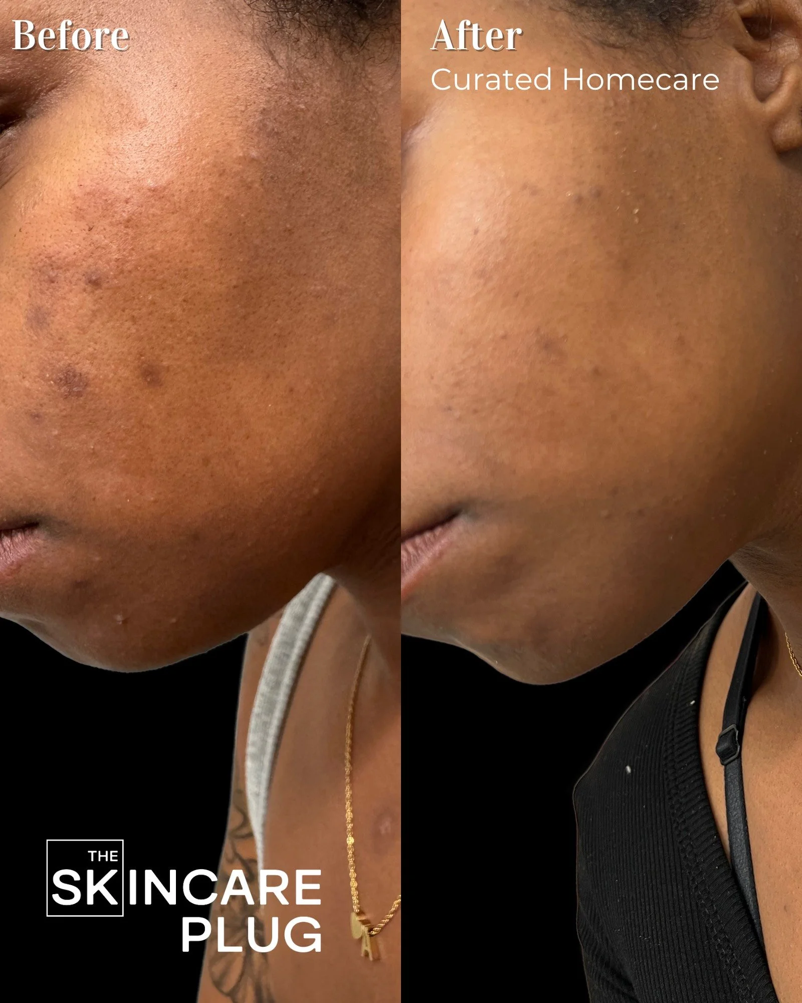 Copy of Before & After.png