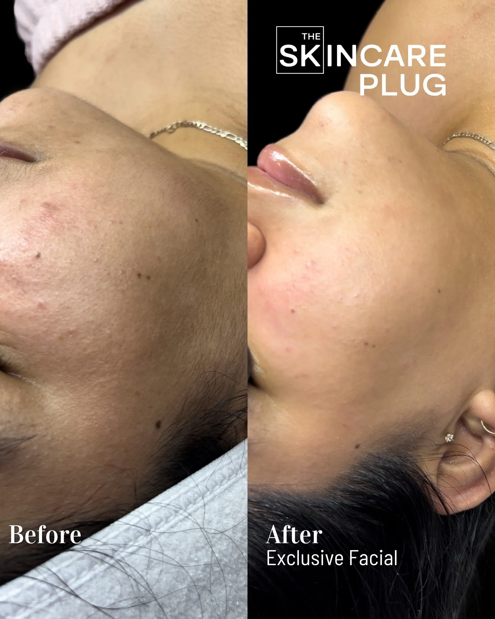 Copy of Before & After_1.png