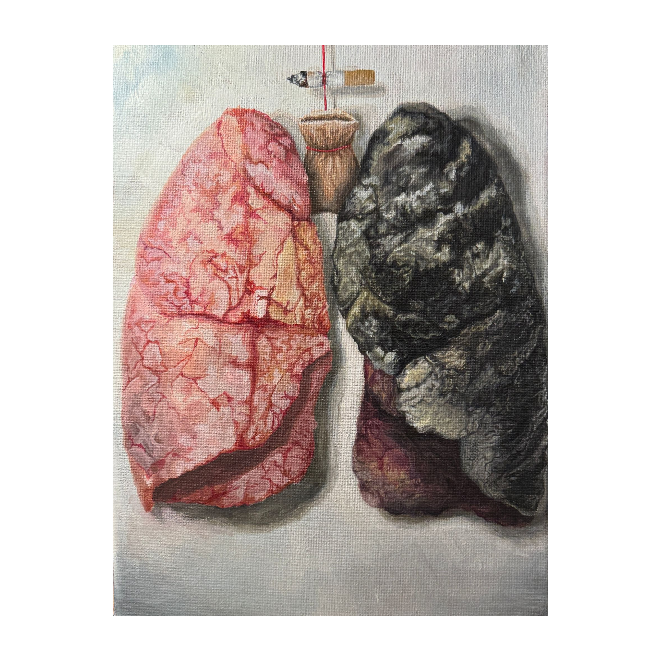 On Display: The Lungs (Print)