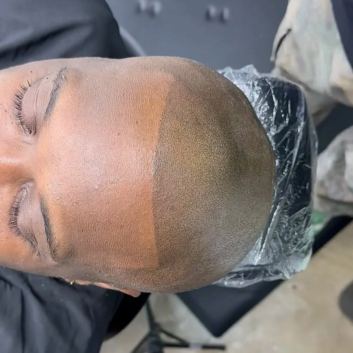 A person with a shaved head and makeup, lying down with eyes closed, receiving a scalp microblading or tattooing procedure in a beauty or salon setting.