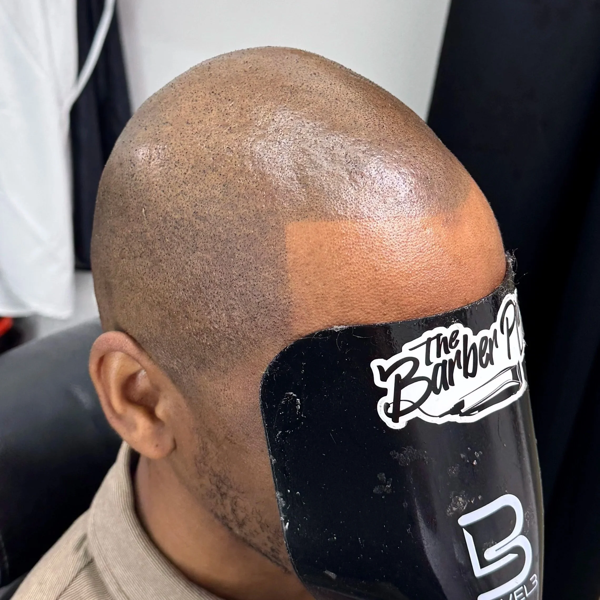 Close-up of a person with a freshly shaved or buzzed head, sitting in a barber's chair, with a black barber shield covering part of their face.