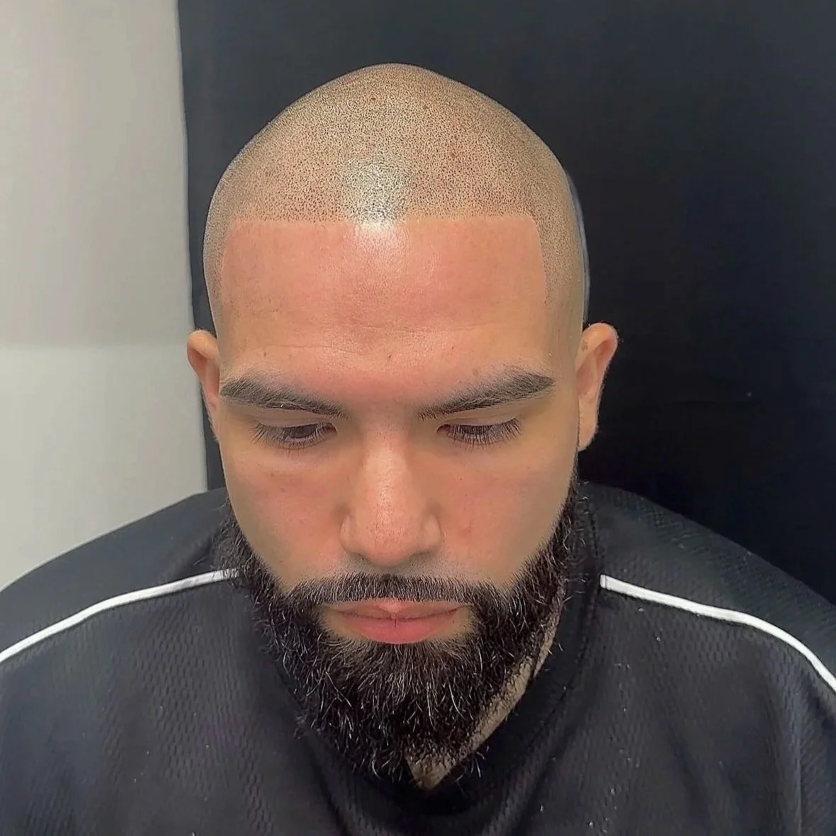 Man with a shaved head and full beard, wearing a black sports jersey, looking down.