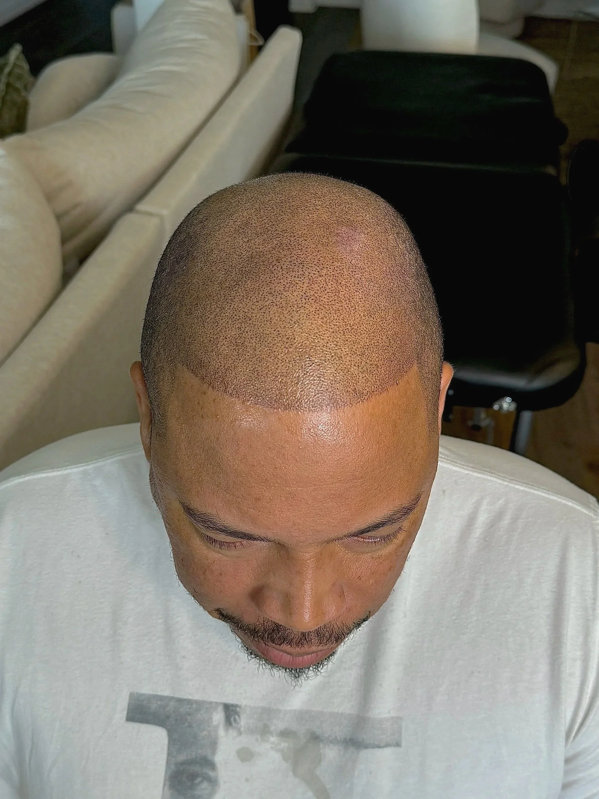 Top view of a man with a fresh bald head, showing stubbly scalp and clean hairline, seated indoors with a white shirt, behind beige and black furniture.