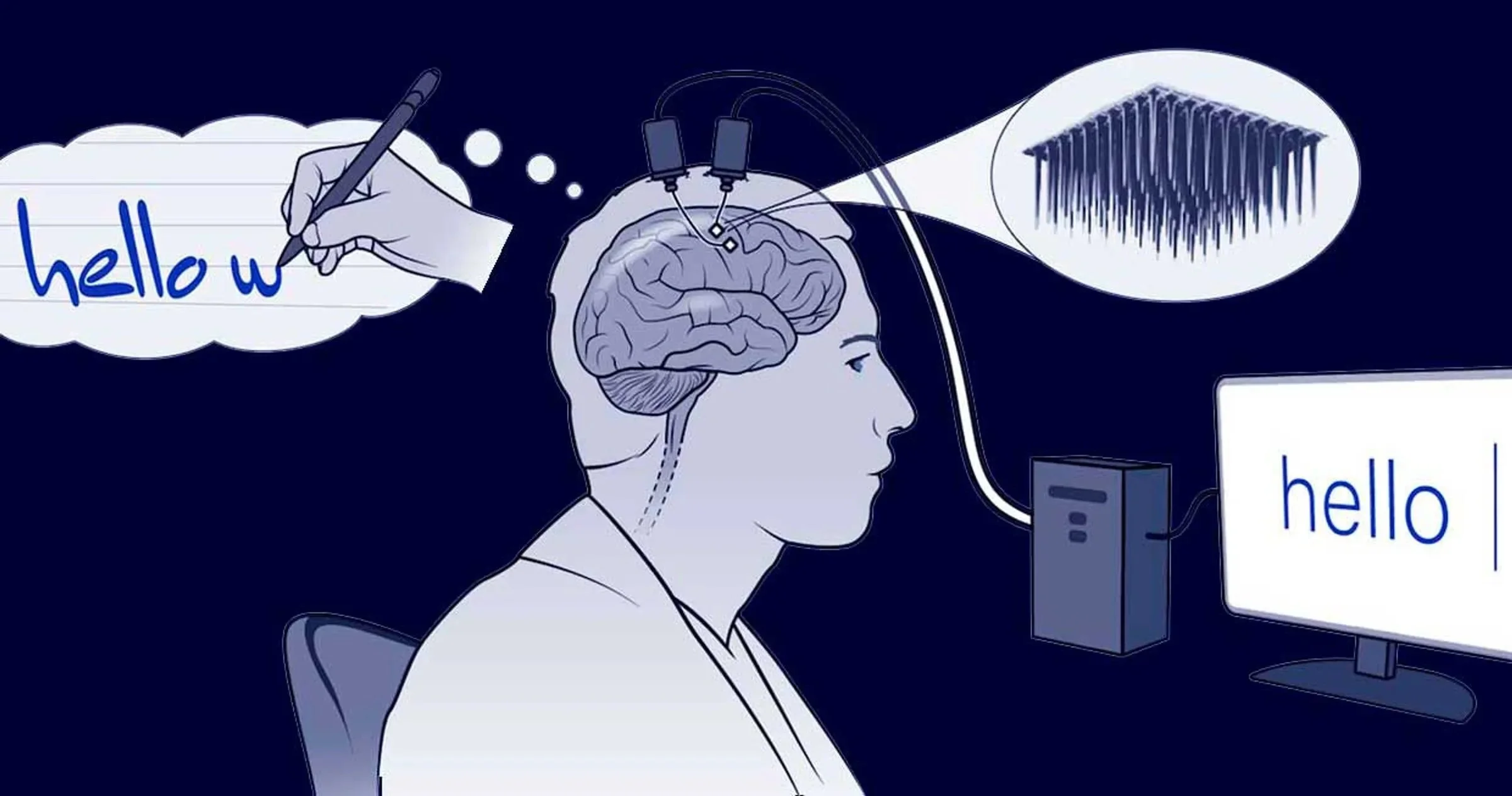 The Tale of the Brain Computer Interface