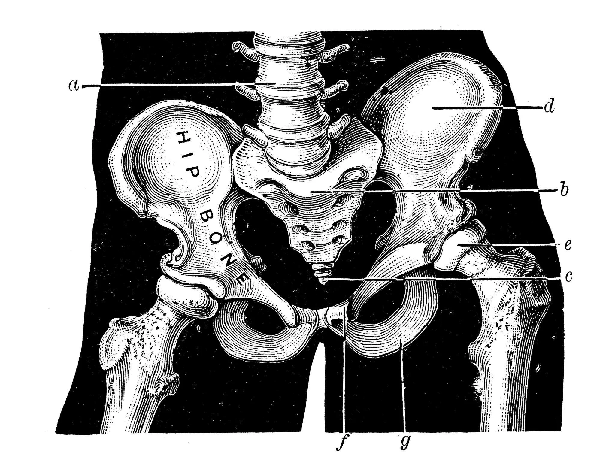 Hip fracture recovery: Best ways to recover after hip fracture surgery
