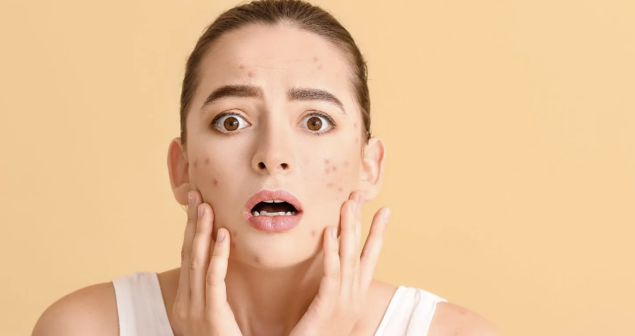 What Causes Irritation After Waxing?