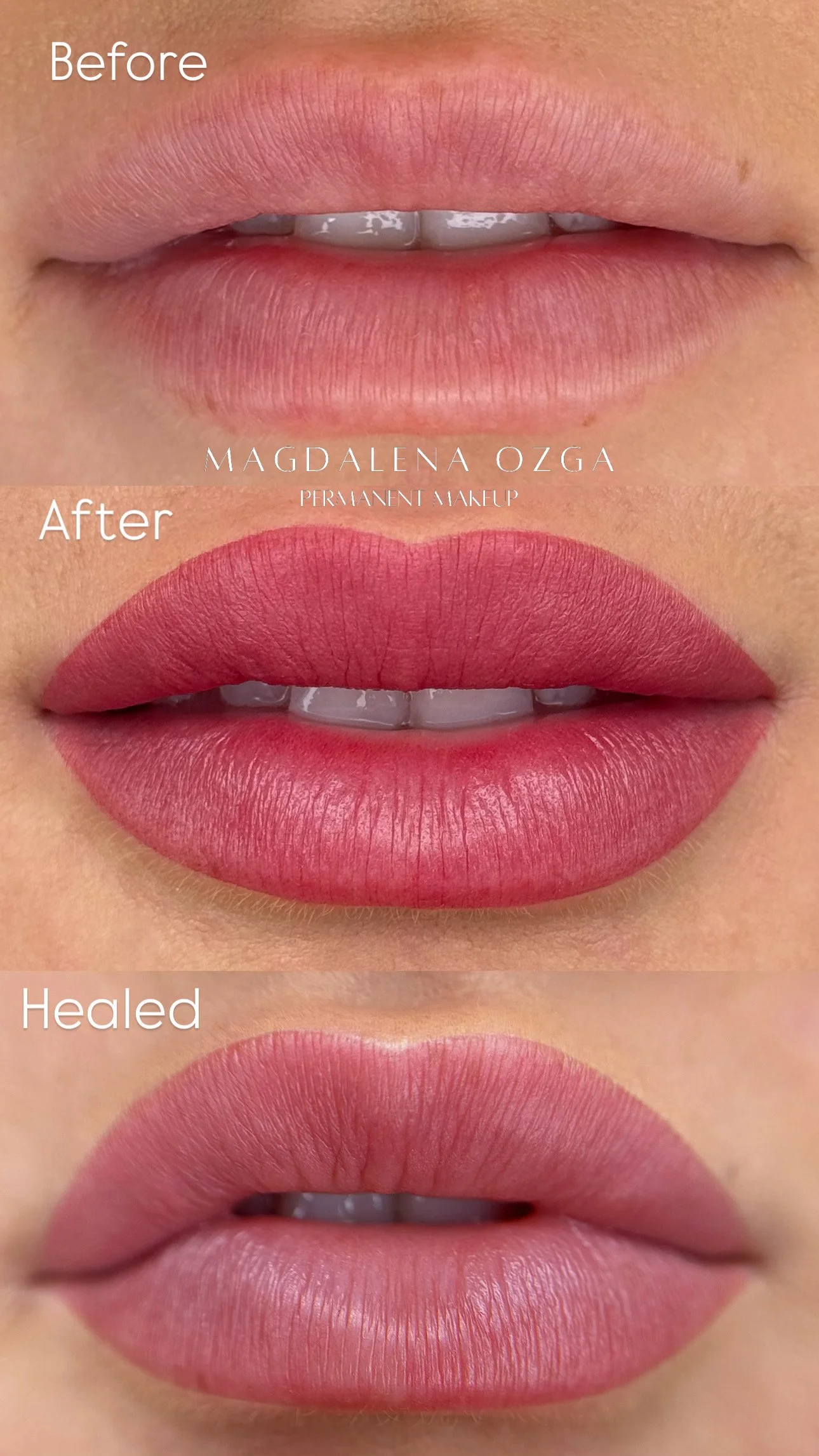 Close-up of lips showing the 'Before' natural lips, 'After' with lipstick application, and 'Healed' lips after healing, all labeled with text.