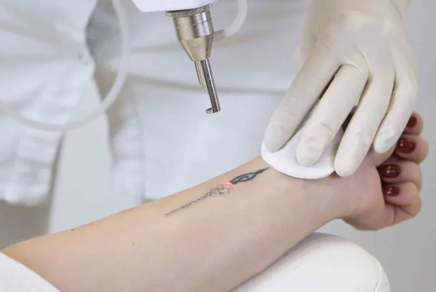 A person is getting a tattoo on their forearm using a tattoo machine, with a gloved hand holding the skin taut.