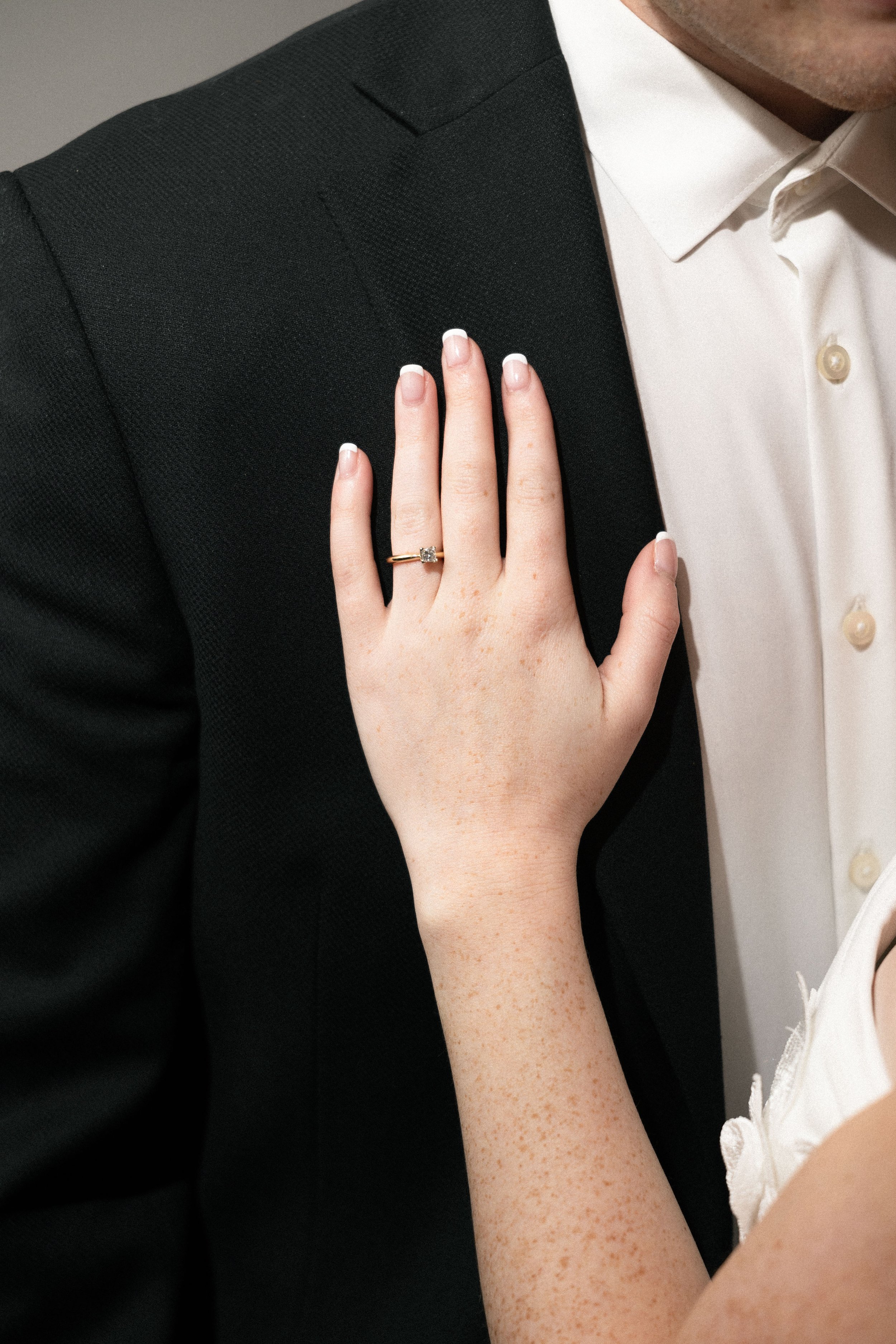 A woman with freckled skin shows her hand with a wedding ring on her finger, resting on a man's suit jacket.