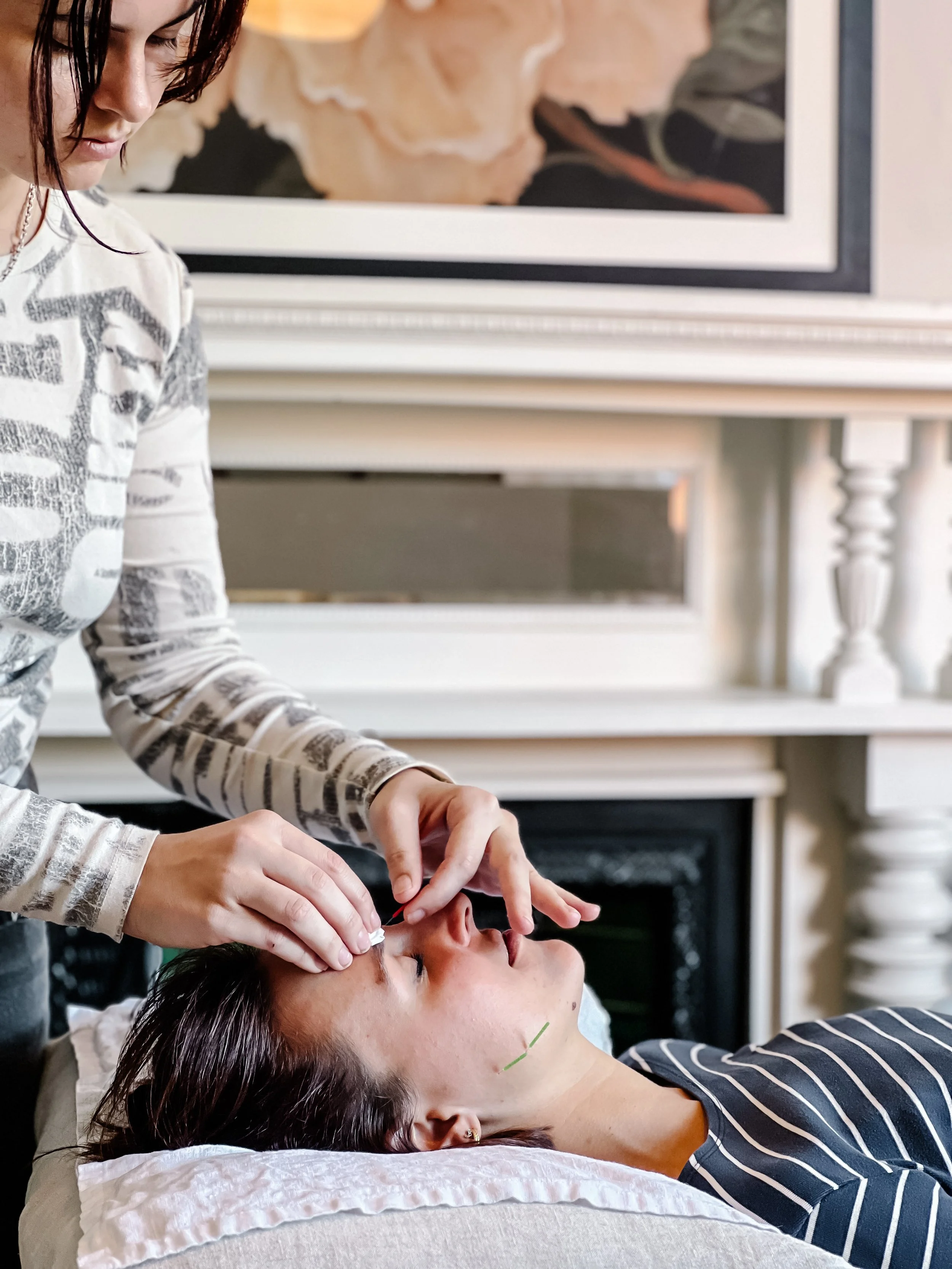 A woman lying on a bed with her eyes closed receives acupuncture treatment from another woman who is inserting acupuncture needles into her face. They are in a room with a decorative framed artwork and a white fireplace.