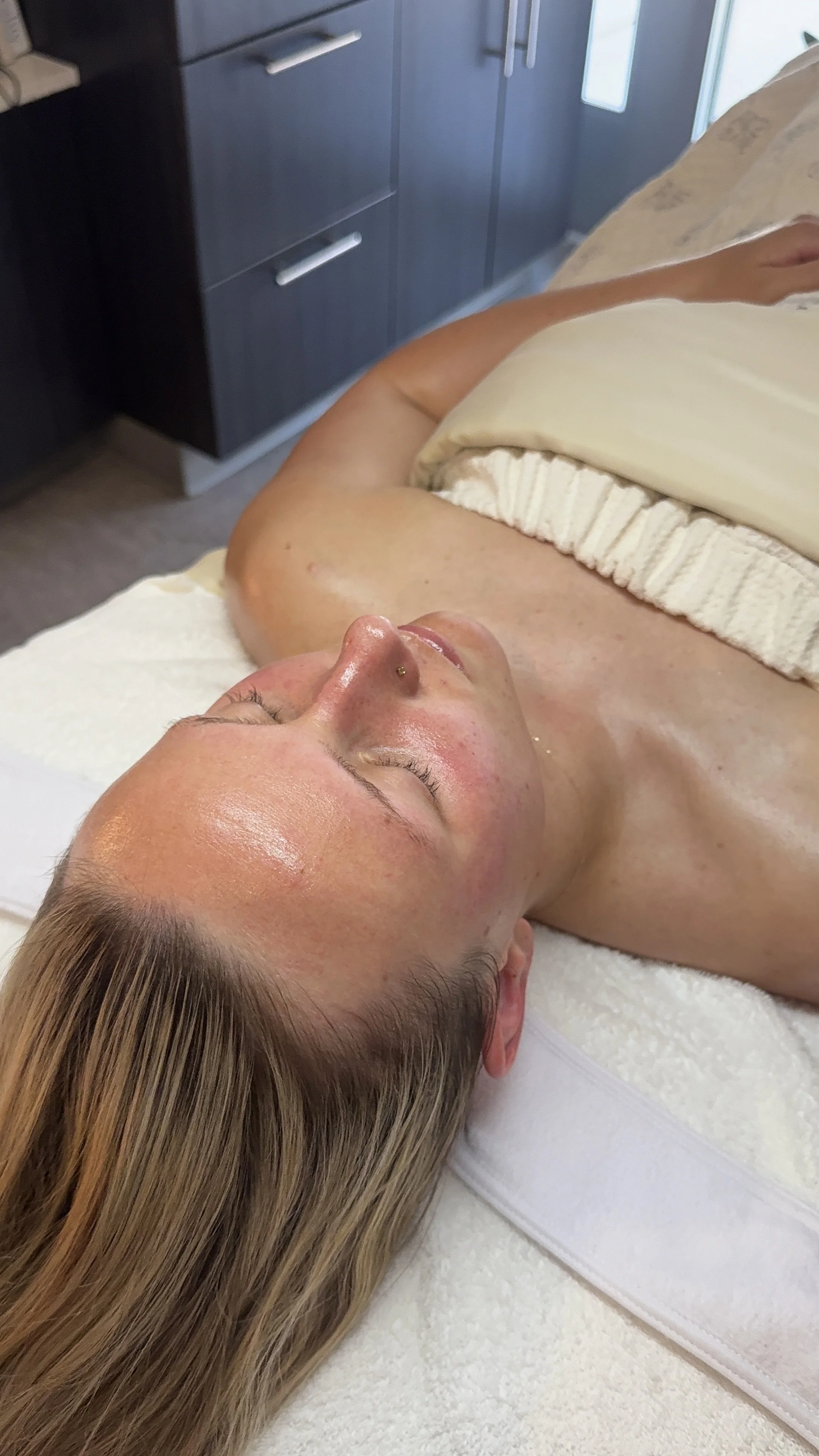 Is Microneedling Worth It for Acne Scars? (And How Aftercare Impacts Your Results)
