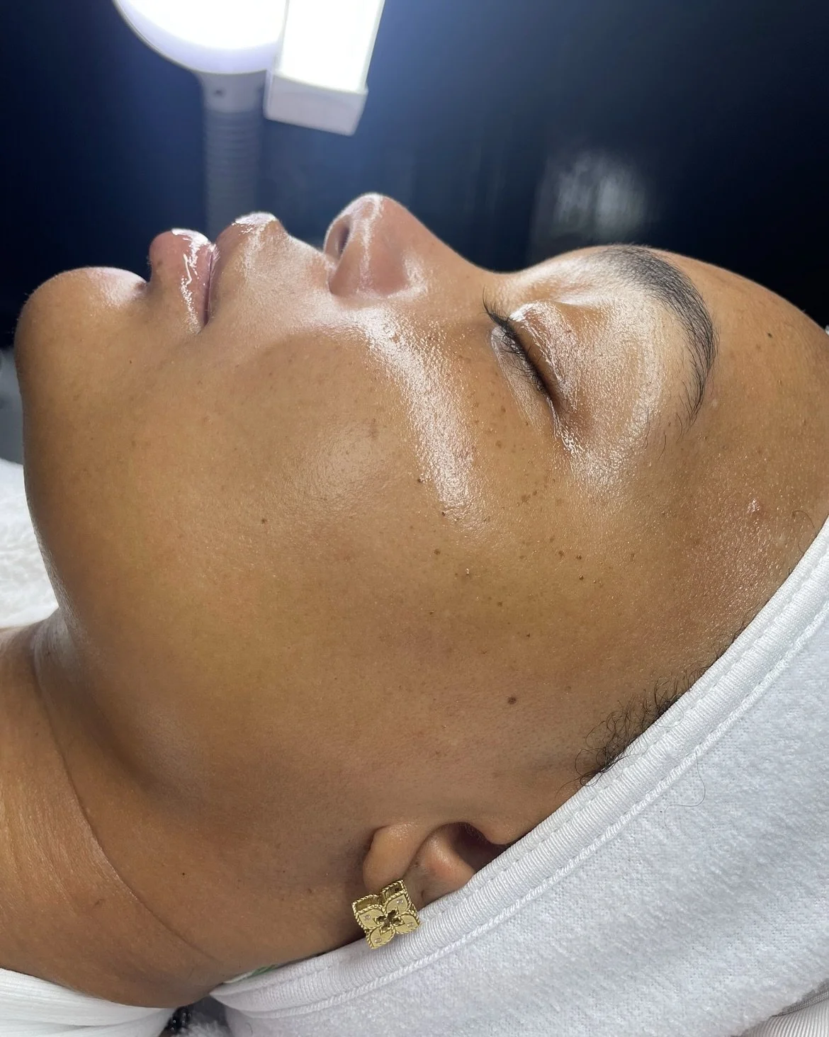 My client&rsquo;s skin is giving smooth, glowing, and absolutely beautiful. I love pairing Dermaplaning with Nano Infusion. It&rsquo;s the perfect, no downtime treatment to get that glass skin effect. ✨🫶🏾

-
-
#sharikaydenisebeauty #skinbyshari #sd