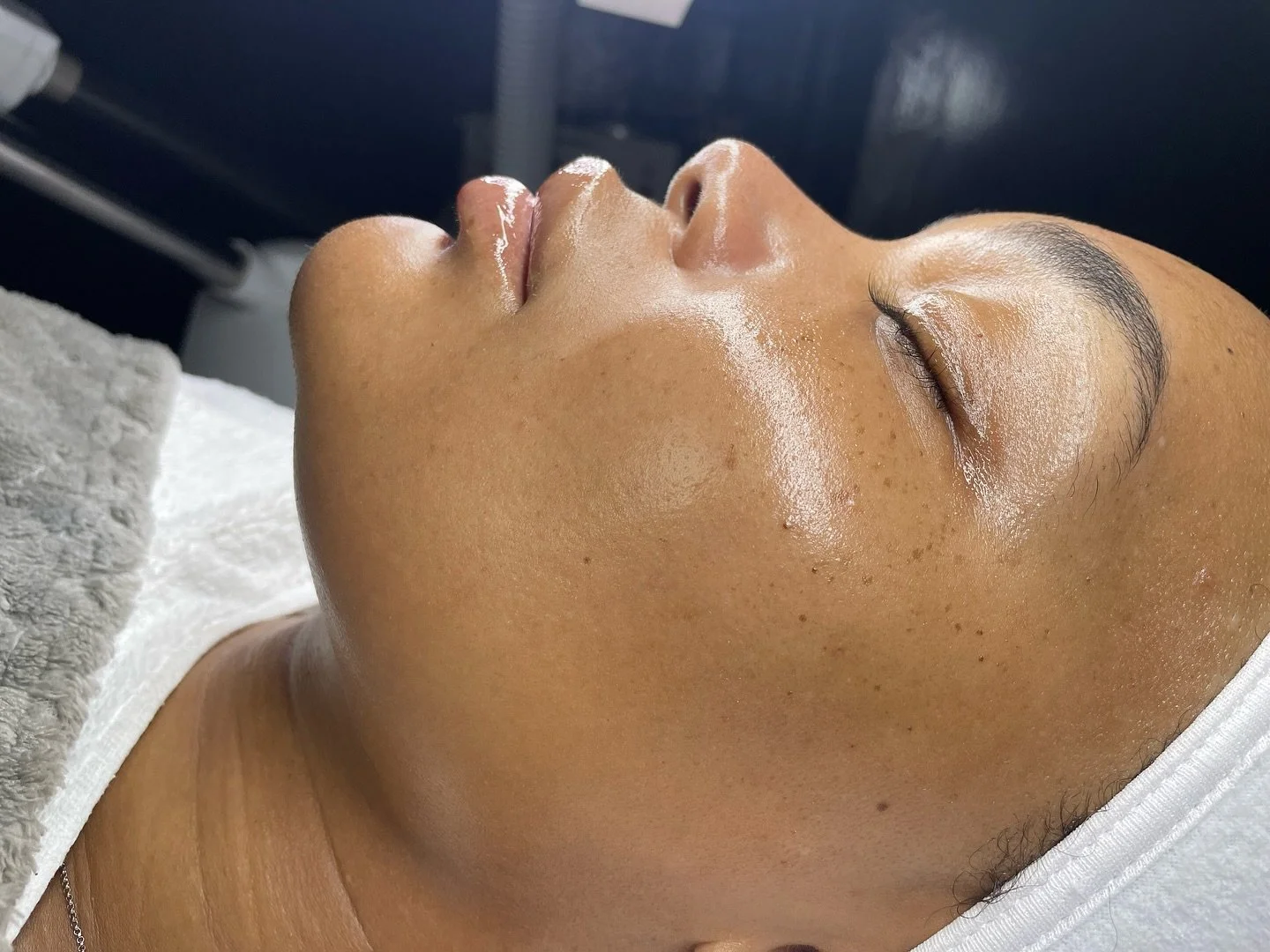 My client&rsquo;s skin is giving smooth, glowing, and absolutely beautiful. I love pairing Dermaplaning with Nano Infusion. It&rsquo;s the perfect no downtime treatment to get that glass skin effect. ✨🫶🏾
-
-
#sharikaydenisebeauty #skinbyshari #sdb 