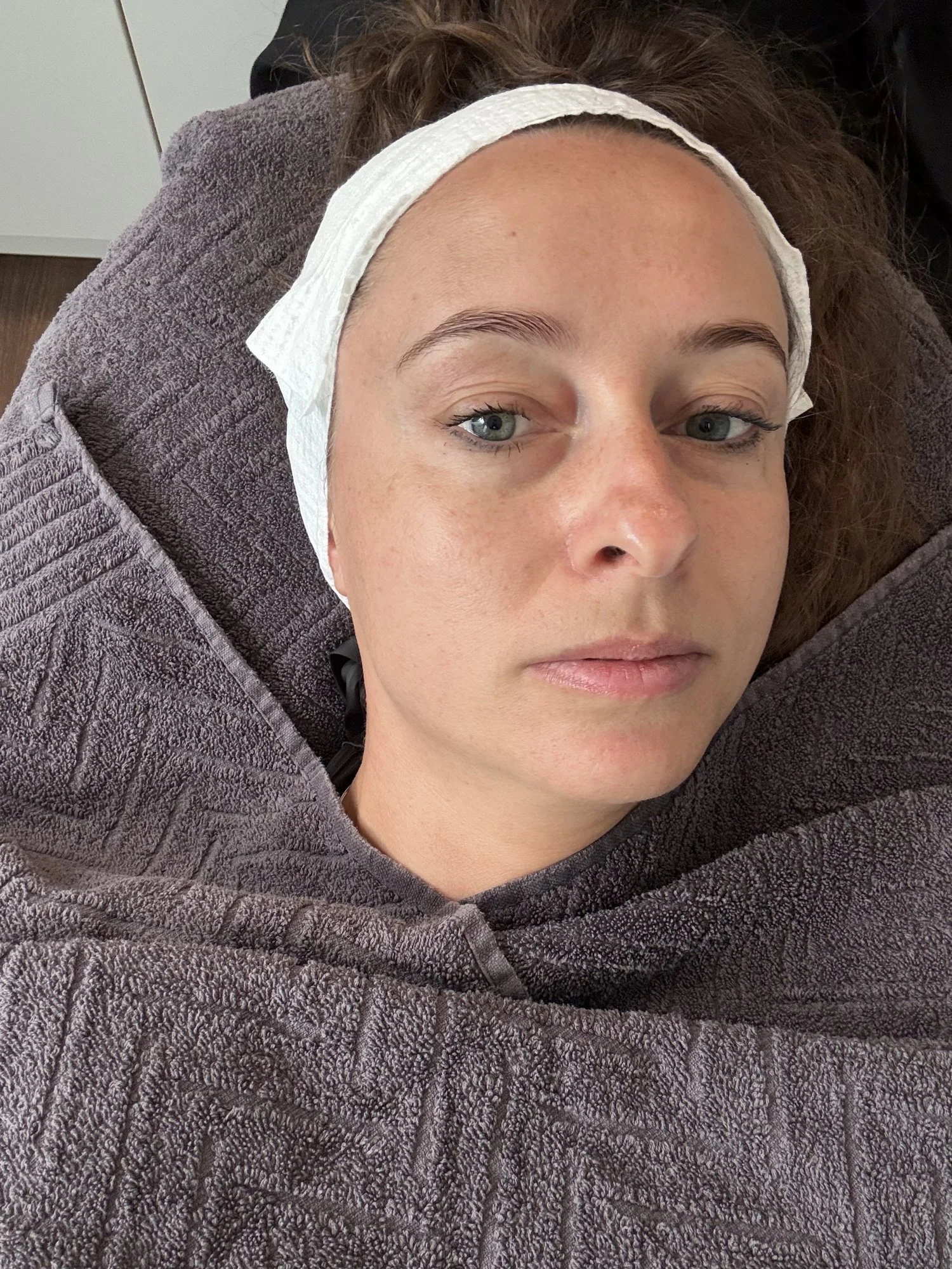 Kate vor der MultiFRAX-Sitzung auf der Behandlungsliege, Haut gereinigt und ungeschminkt