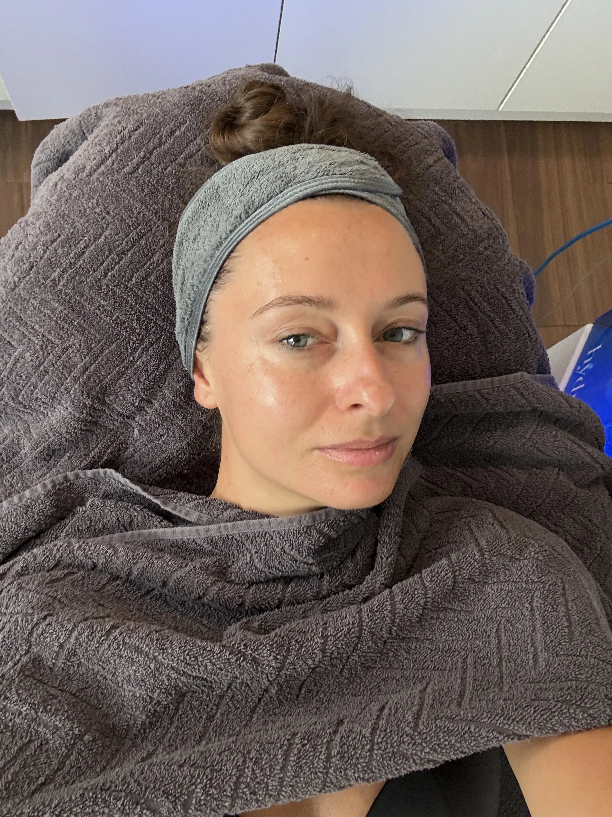 Kate testet: HydraFacial – Glow für die Mittagspause