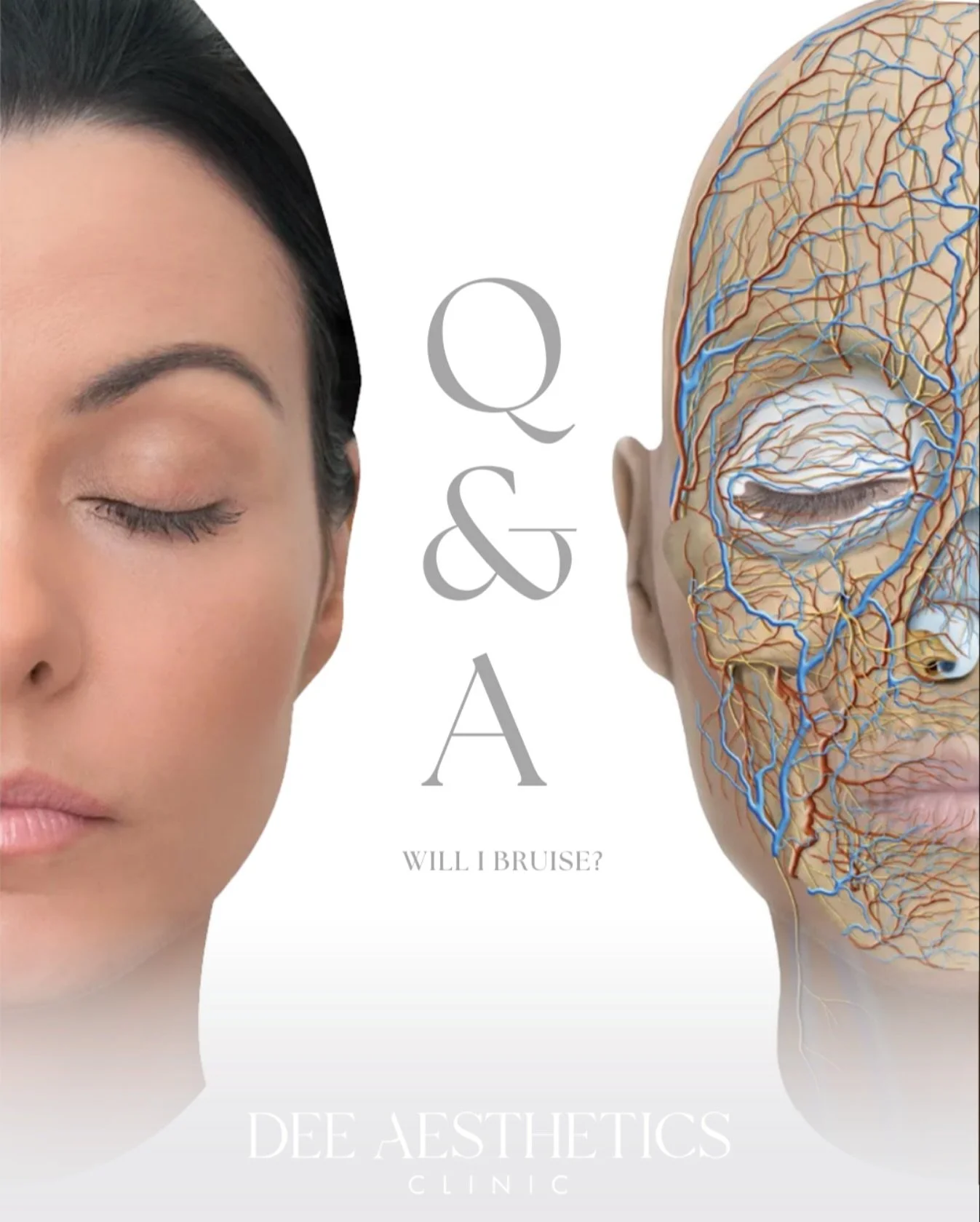 WILL I BRUISE?

This is a question we frequently hear. Considering the high vascularity of the face, bruising is a valid concern.

Our approach is always focused on minimising trauma however, there are also a few simple things you can do to help redu