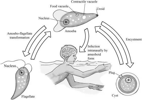 🟡 Pediatric Fatality from Brain-Eating Amoeba in South Carolina