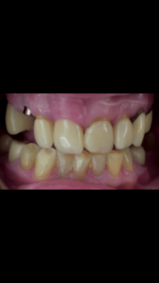cosmetic dentistry, full mouth reconstruction