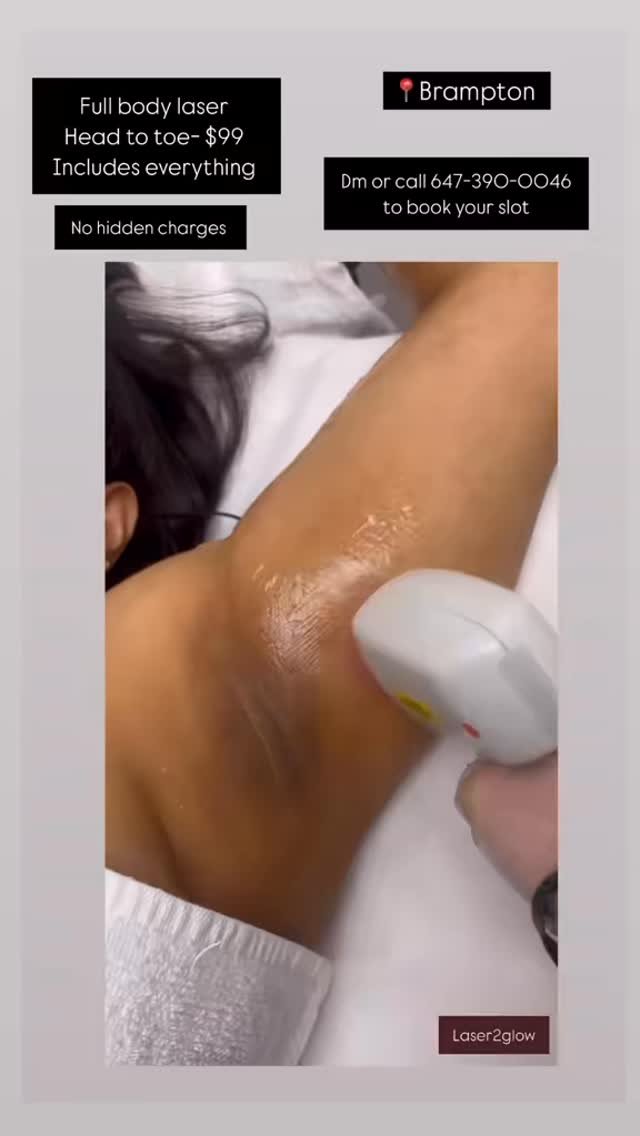 Full body Laser- $99 (head to toe)
Includes everything
📍Brampton
Dm to book
#fyp #brampton #laserhairremoval #toronto
