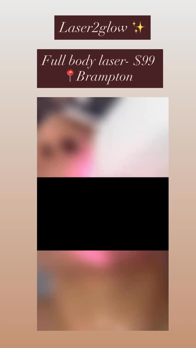 Full body laser -$99 (Head to toe)
📍Brampton
Dm or call (647-390-0046) to book appointment
#fyp #laserhairremoval #brampton #laser2glow #toronto
