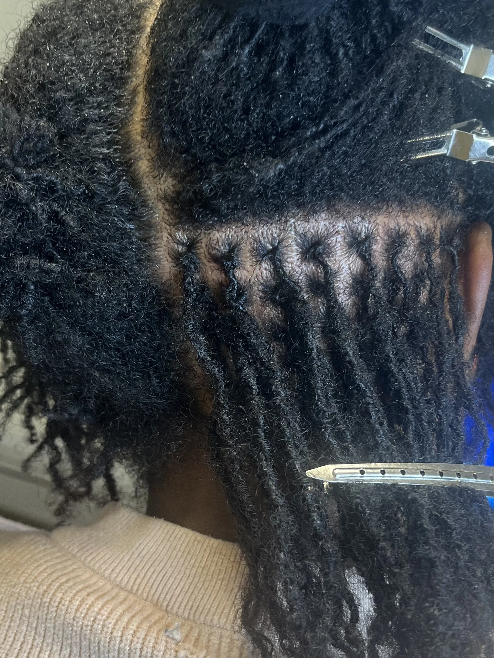 Person with twisted dreadlocks in the process of being styled or tightened, with hair clips holding sections in place.