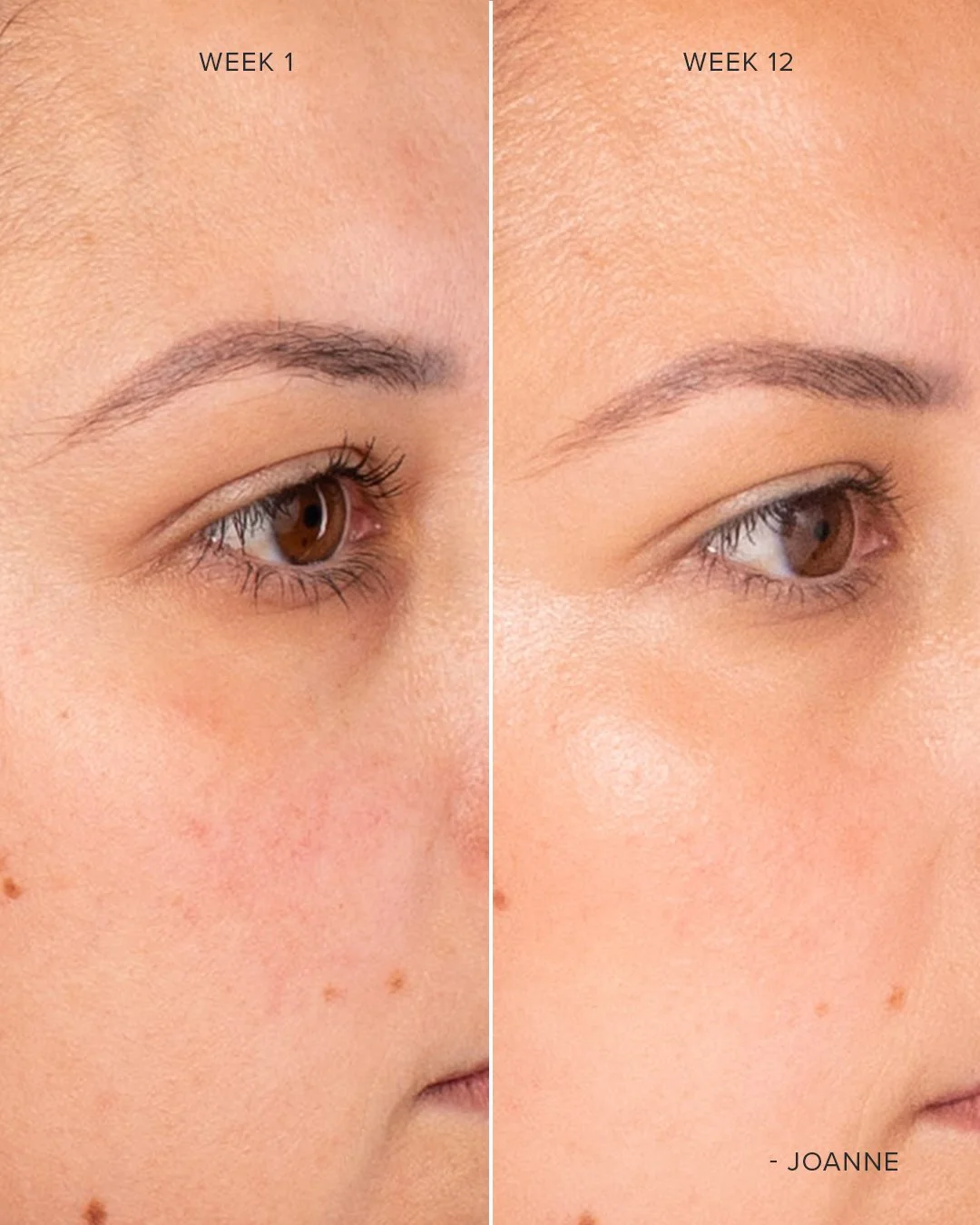 ORGANIC - 12 week Collagen Commitment Results - 9b.jpg