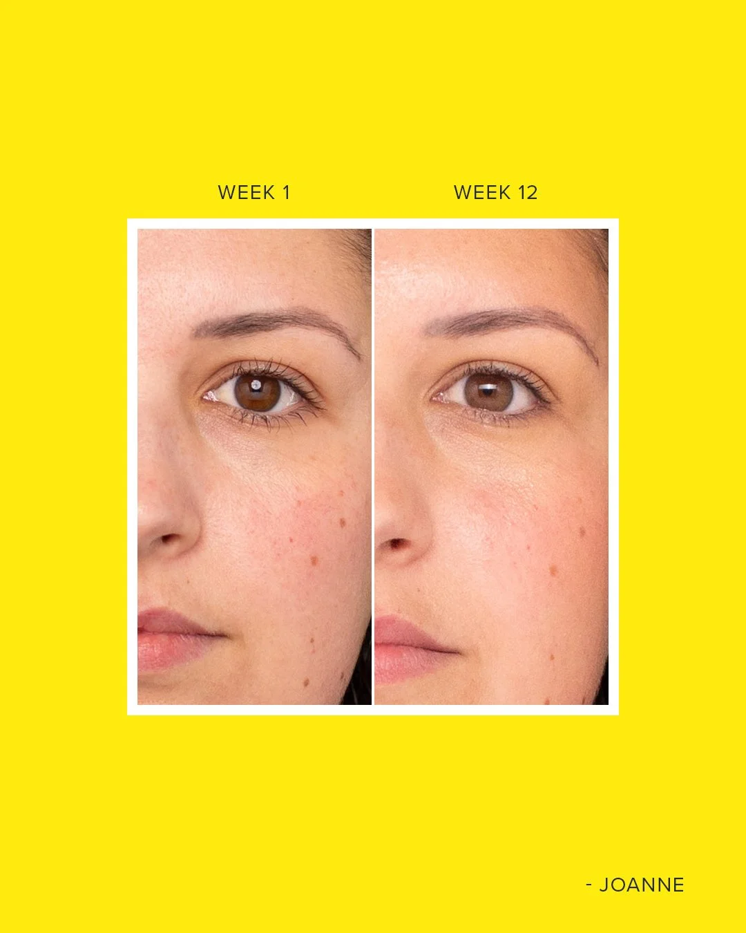 ORGANIC - 12 week Collagen Commitment Results - 7.jpg