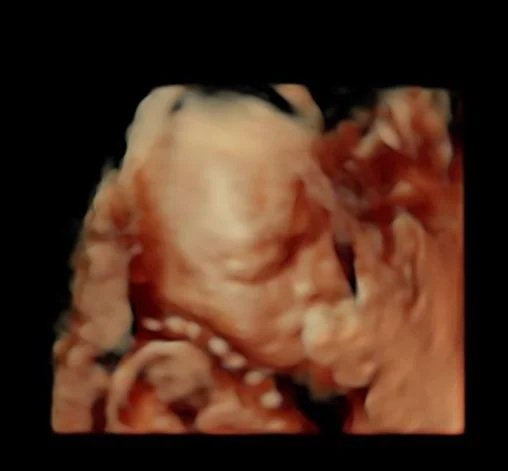 3 Pregnancy Expenses Nobody Warned Me About