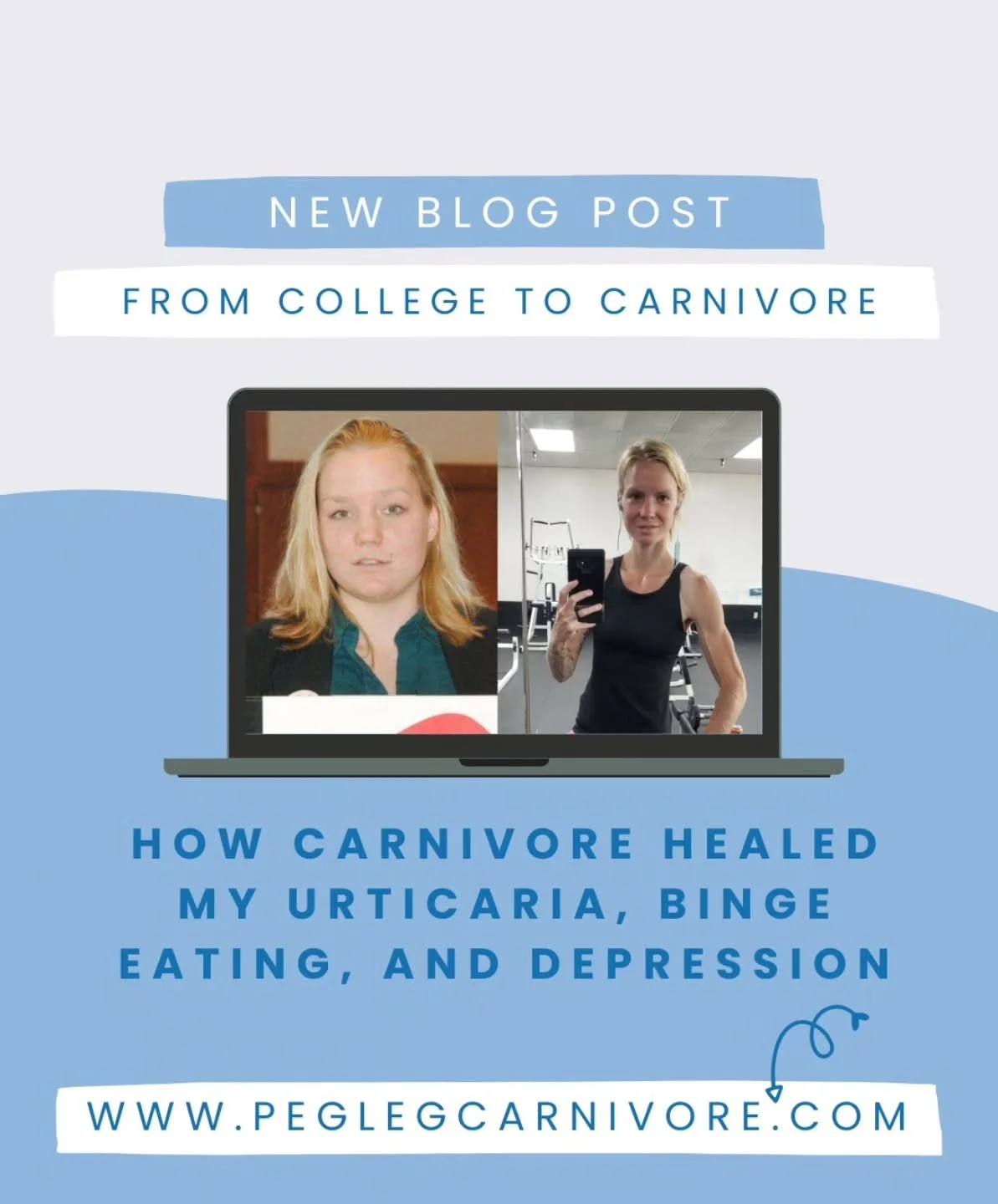 Many of you know my struggles with anorexia and amputation, but in college I struggled with binge eating, depression, and inflammatory skin conditions. I get real in this blog post, and it was a bit scary to press the &quot;publish&quot; button. 

ww