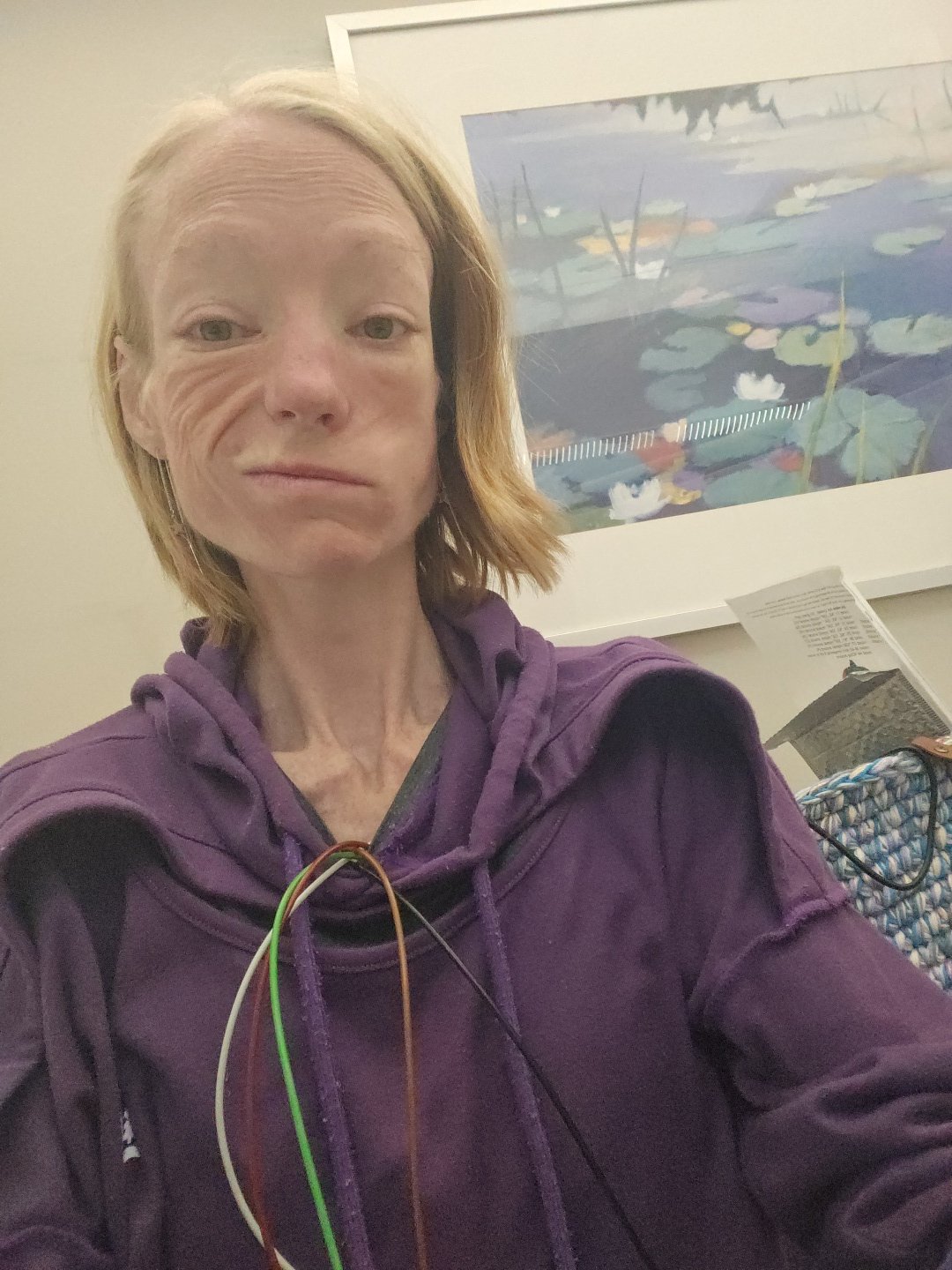 Déjà Vu in the Hospital