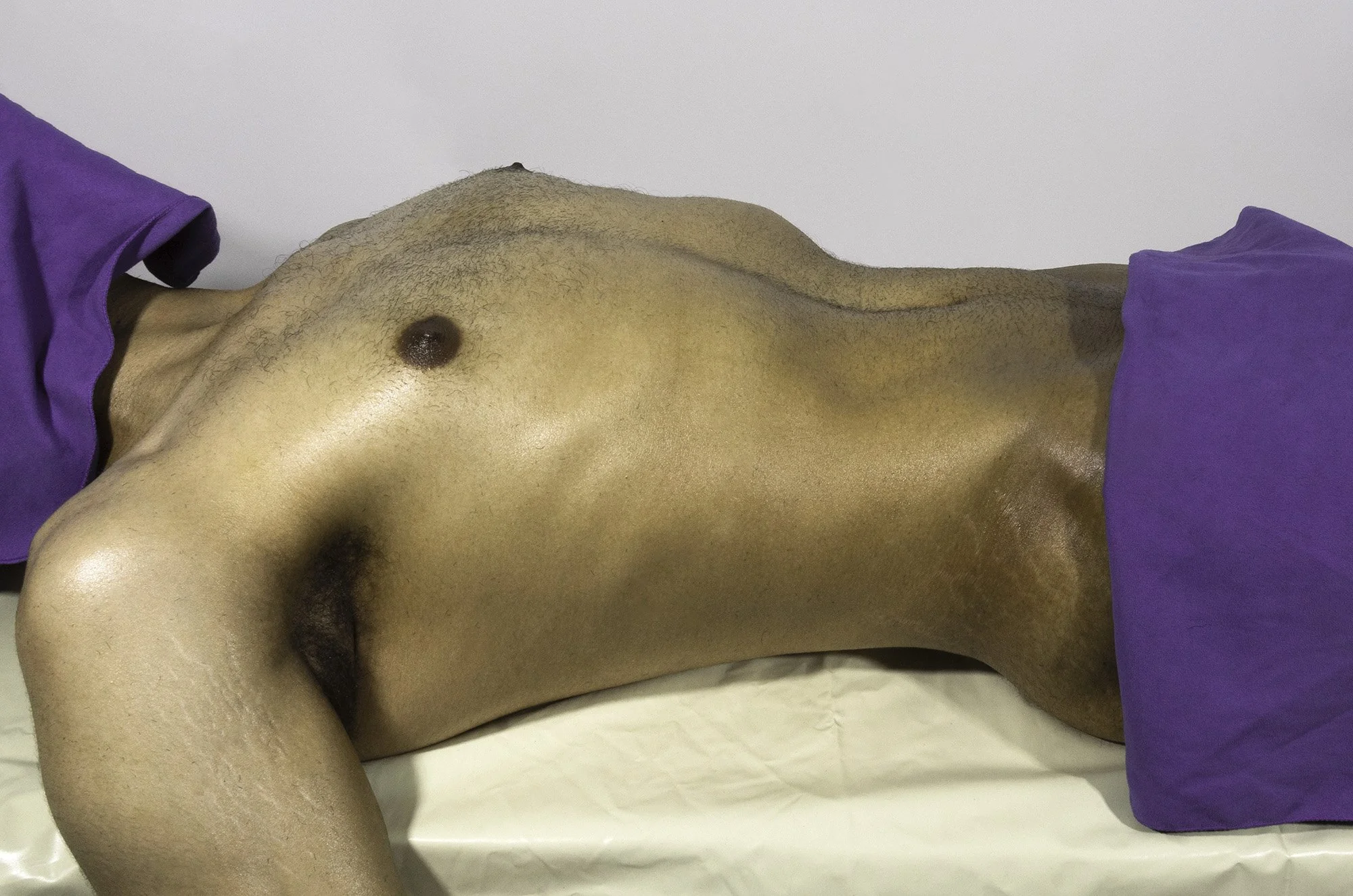 A topless man lying on his side on a hospital bed with a purple sheet covering his legs. The focus is on his chest and abdomen, with visible body hair and skin texture.
