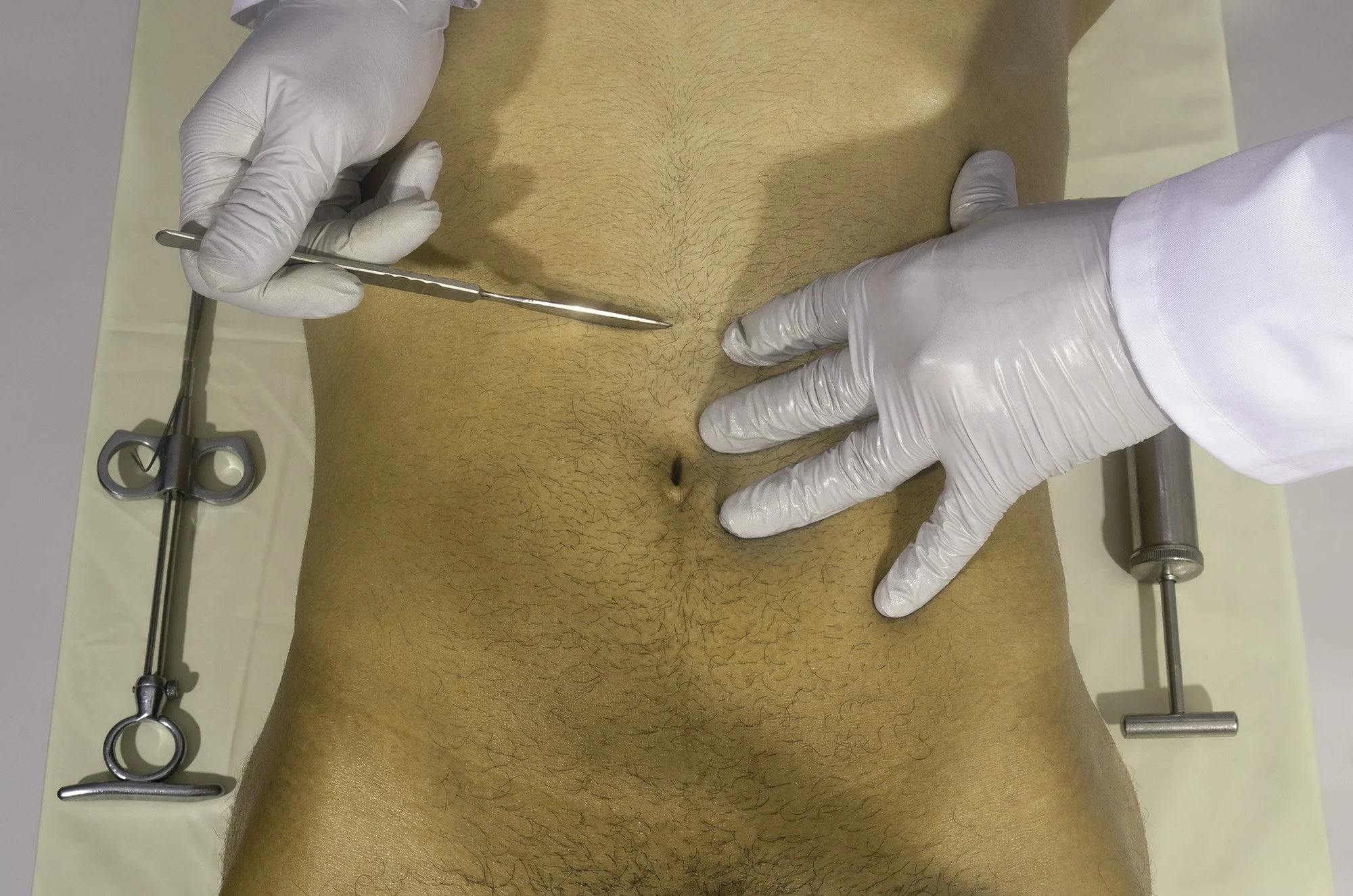 Medical professional in white gloves examining a patient’s abdomen with a surgical instrument, surgical tools on a table nearby.