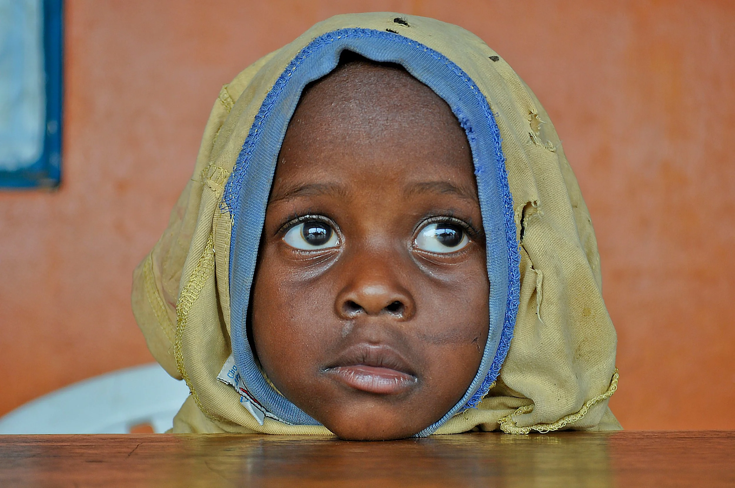 1-Year Projected Deaths from International Aid Funding Discontinuation