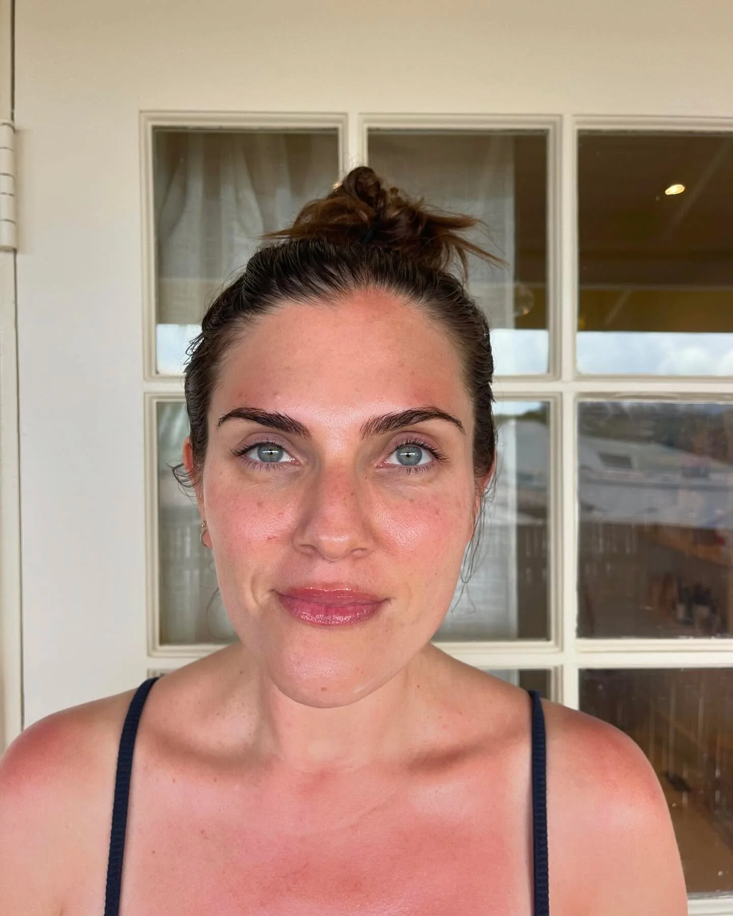 that post Dermaplane + BioRePeel GLOW✨🤩