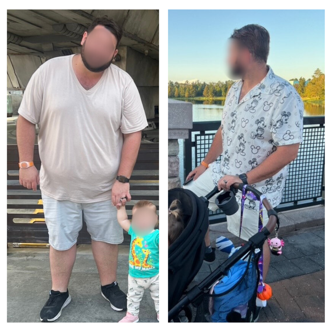 Before and After (1).png