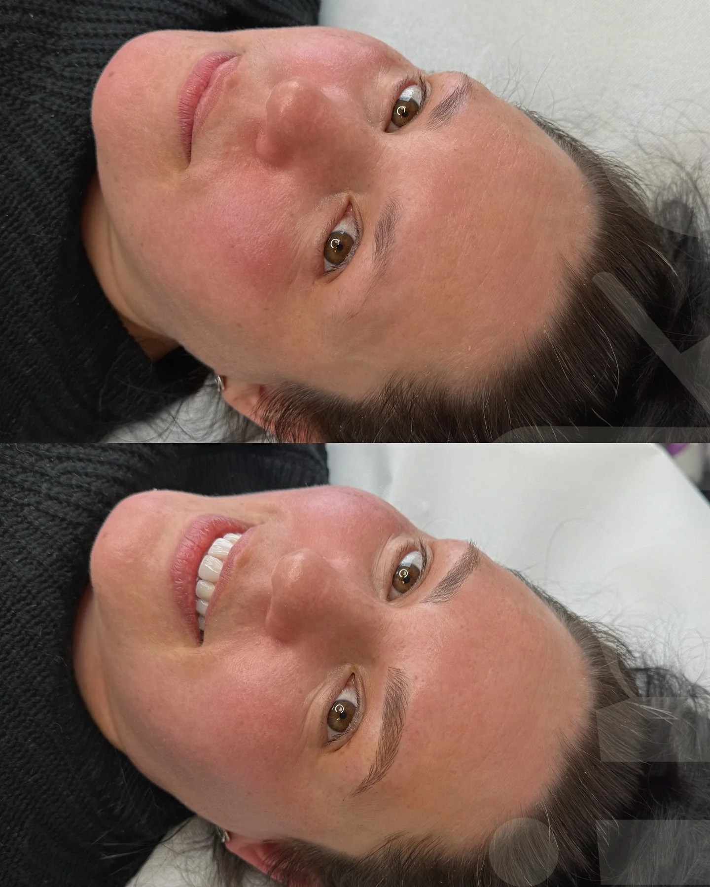 &ldquo;I wish I&rsquo;d done it years ago&hellip;&rdquo; 

Suuuuch an unreal transformation for lovely E today!!! E was so nervous when she arrived, in fact she paid in full at her consultation a few weeks ago because she said she wouldn&rsquo;t turn
