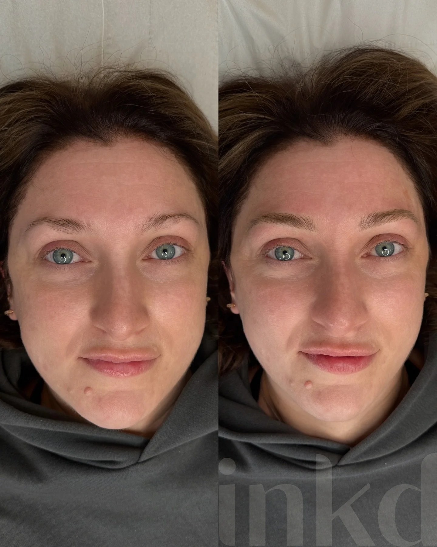 Gorgeoussss❤️

Microblading restoring volume and shape 👏🏻 

@brovi.uk roasted chestnut 
@killerbeautypmu 0.18 18U
Cost: &pound;270 + &pound;50 topup 

#microbalding #microbladinguk #microbladingliverpool