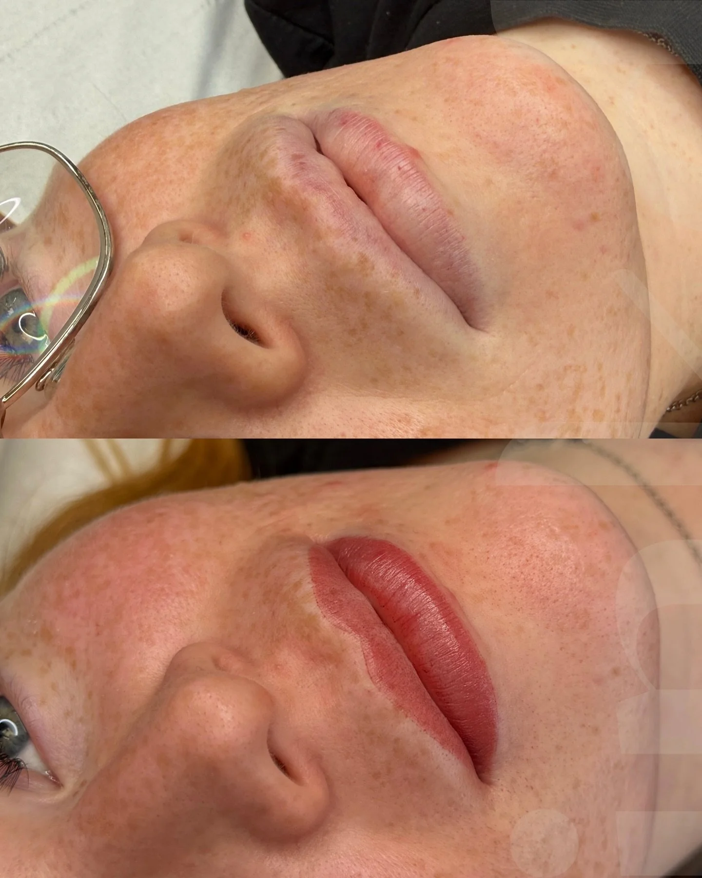 Giving these lips back some shape and definition 👄

These lips will heal to a &ldquo;no I just have great lips&rdquo; sheer gorgeous result 👌🏻 perfect for when you don&rsquo;t wear makeup daily and just need that little bit of colour back ❤️

@bro