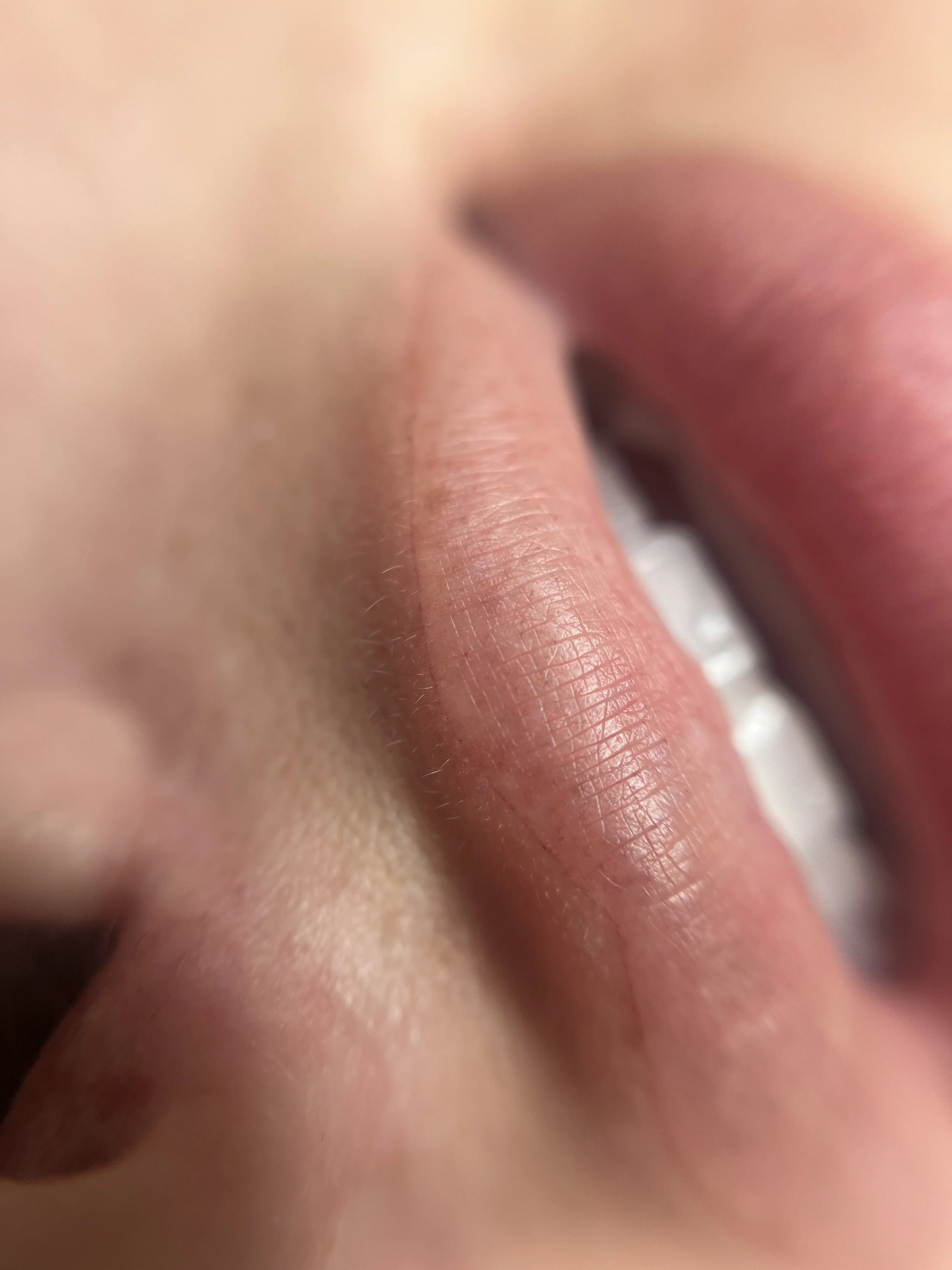 Close-up of a person's lips and part of their face, with emphasis on the lips' texture and natural color.