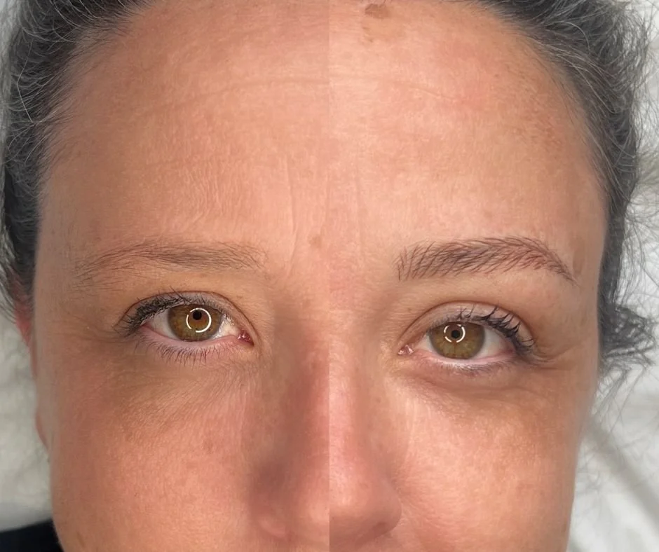 A close-up of a woman's face with visible half face makeup before and after skincare treatment, showing skin texture and eye details.