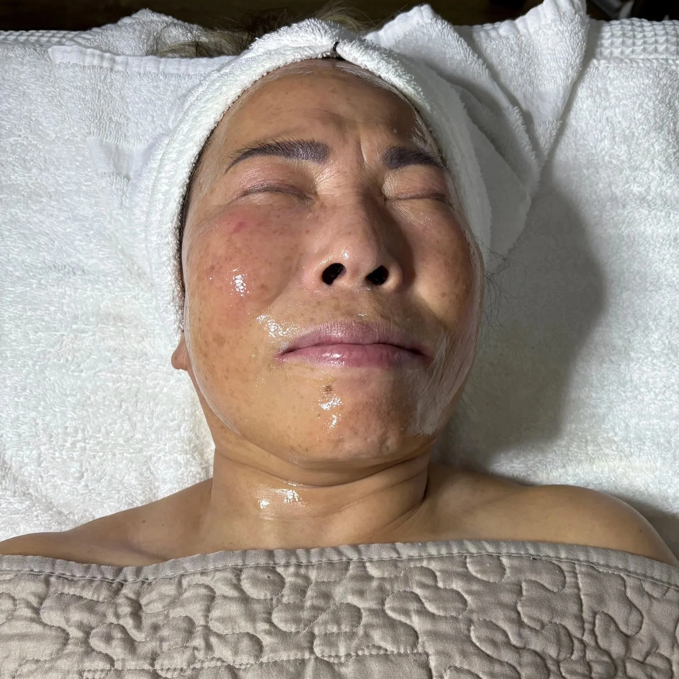 Woman lying with closed eyes, receiving a facial treatment, covered with a beige quilt, with a white towel wrapped around her head.