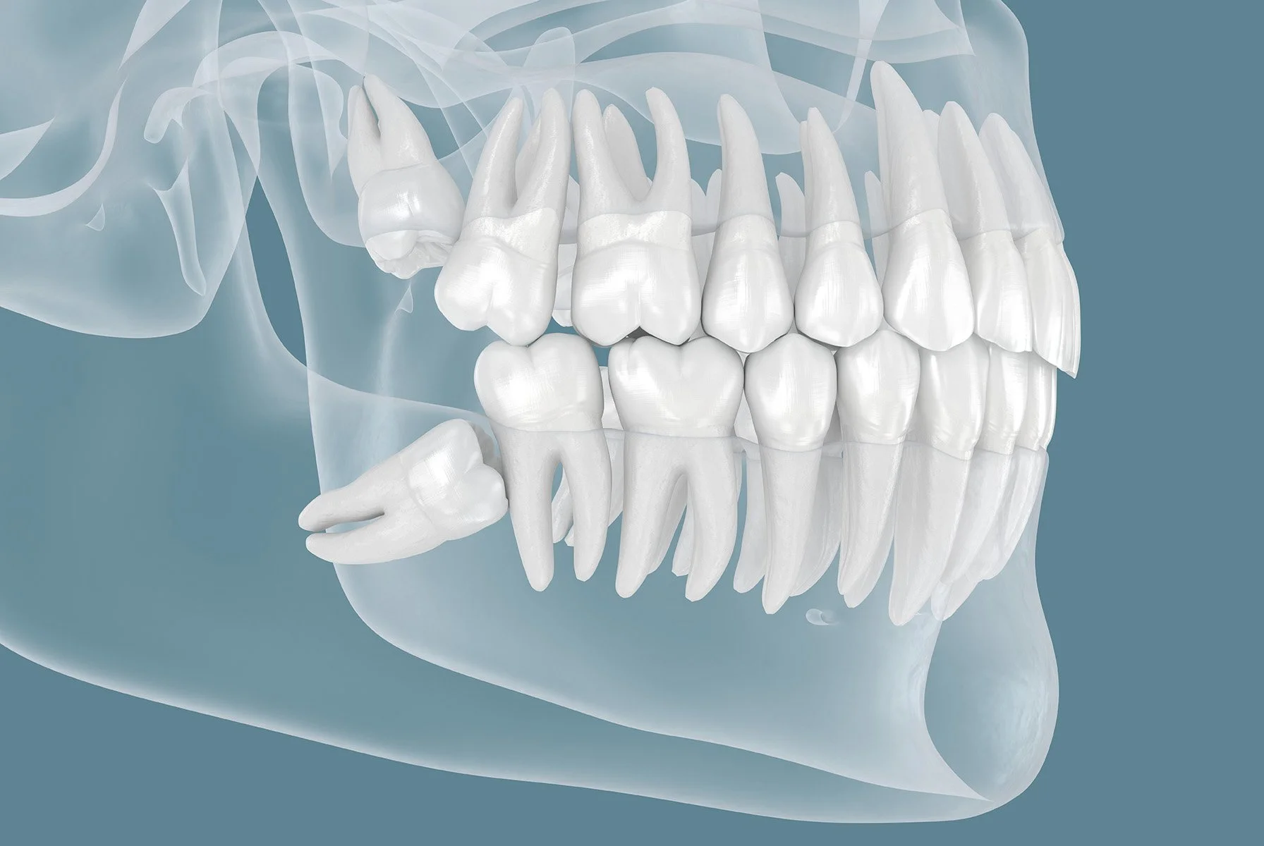 Oral Surgery Remeura Auckland