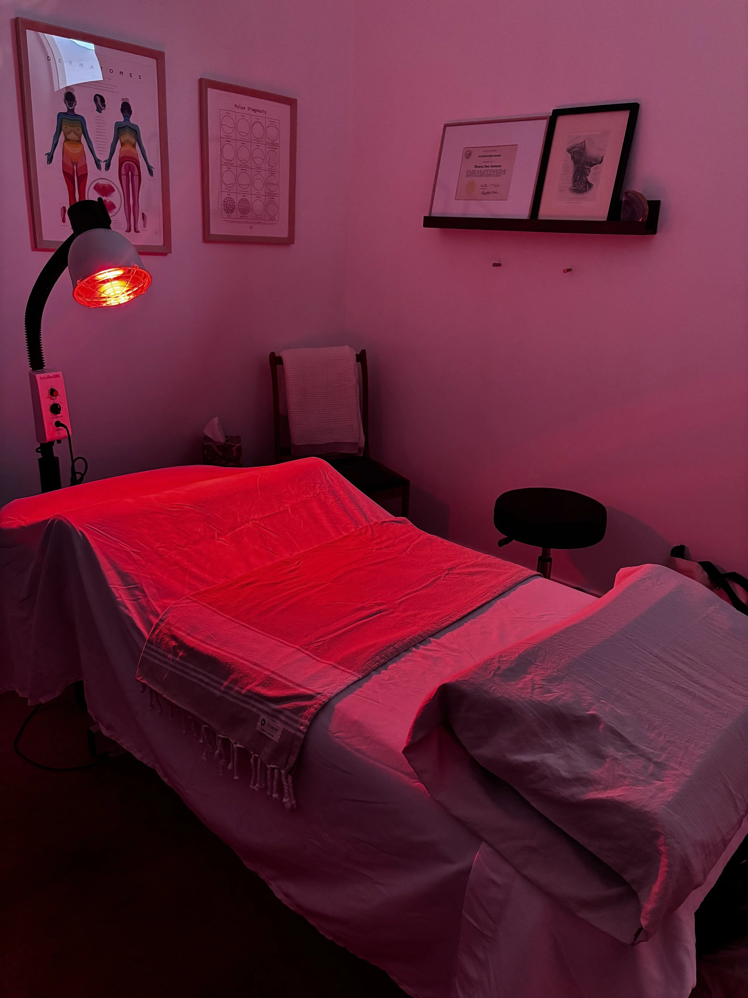 IVF and Acupuncture: When to Start and How It Can Support Your Cycle