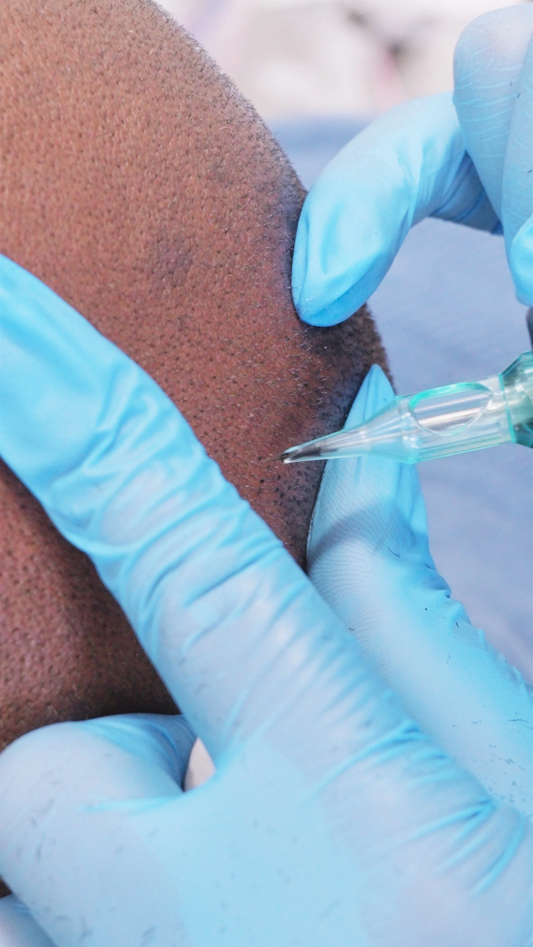 Close-up of a medical professional wearing blue gloves administering an injection or vaccination into a person's skin.