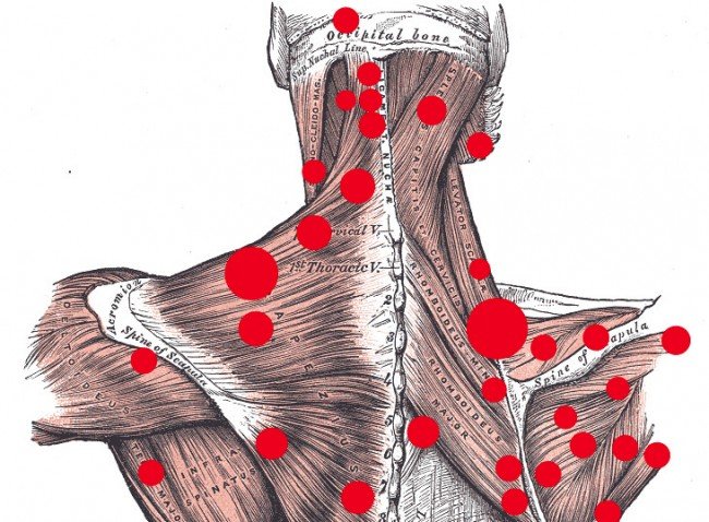 Why a Multifaceted Approach to Healing Matters — Trigger Point Therapy in Los Cabos